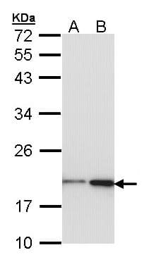 NME1 / NM23 Antibody