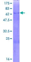 Human BCAT2 Protein (Recombinant GST)