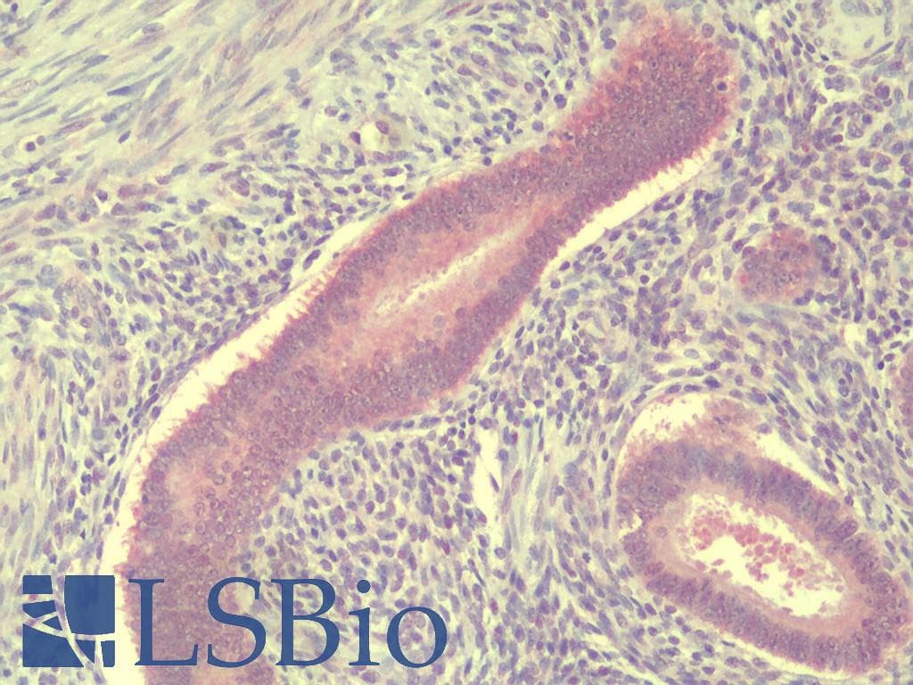 IHC-plus™ TSN / Translin Antibody