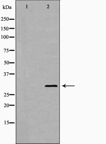 IGFBP7 / TAF Antibody