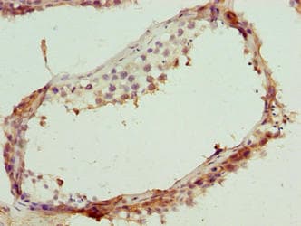 Polyclonal Rabbit anti-Human TEX35 / C1orf49 Antibody (IHC, WB)