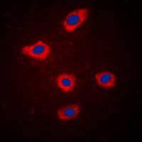 Polyclonal Rabbit anti-Human MELK Antibody (Internal, IHC, IF, WB)