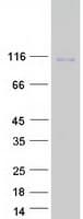 Human PCDH10 Protein (Recombinant Myc-DDK (Flag))