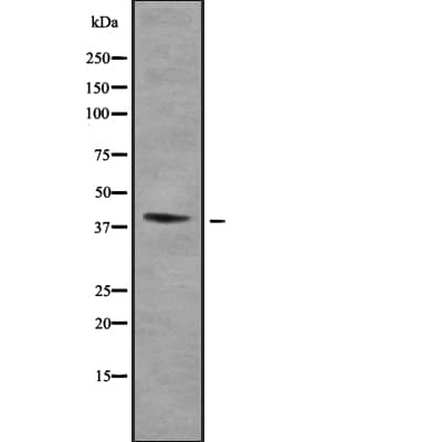 HOXA2 Antibody