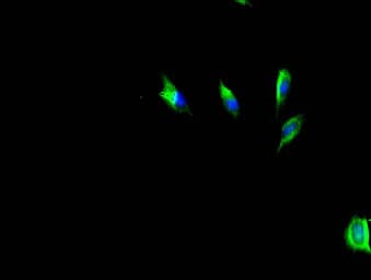 Polyclonal Rabbit anti-Human HAS3 Antibody (aa339-553, IHC)