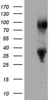 ERCC1 Antibody (clone OTI3B1)