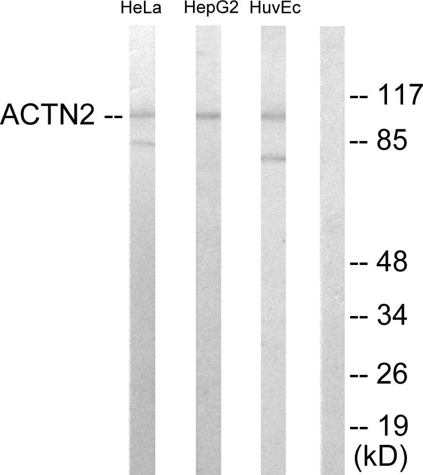 Actinin-Alpha 2+3 Antibody