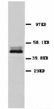 ENO2 / NSE Antibody (C-Terminus)