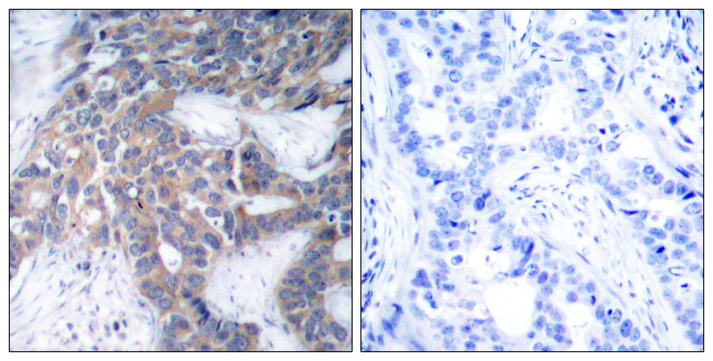 MEK1 + MEK2 Antibody (phospho-Ser217)