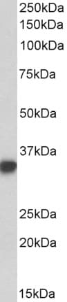 IHC-plus™ CD74 / CLIP Antibody (Internal Region)