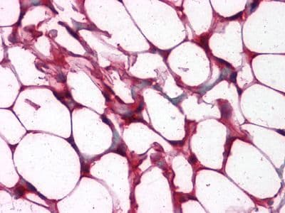ETS1 / ETS-1 Antibody (clone 8A8)