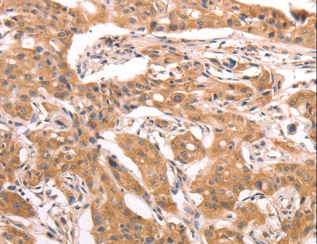 Polyclonal Rabbit anti-Human AASDHPPT / LYS5 Antibody (IHC, WB)