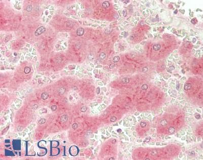 IHC-plus™ Polyclonal Rabbit anti-Human RBP4 Antibody (aa 70-112, IHC)