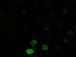 Monoclonal Mouse anti-Human MAPK8 / JNK1 Antibody (clone OTI4E3, IF, WB)