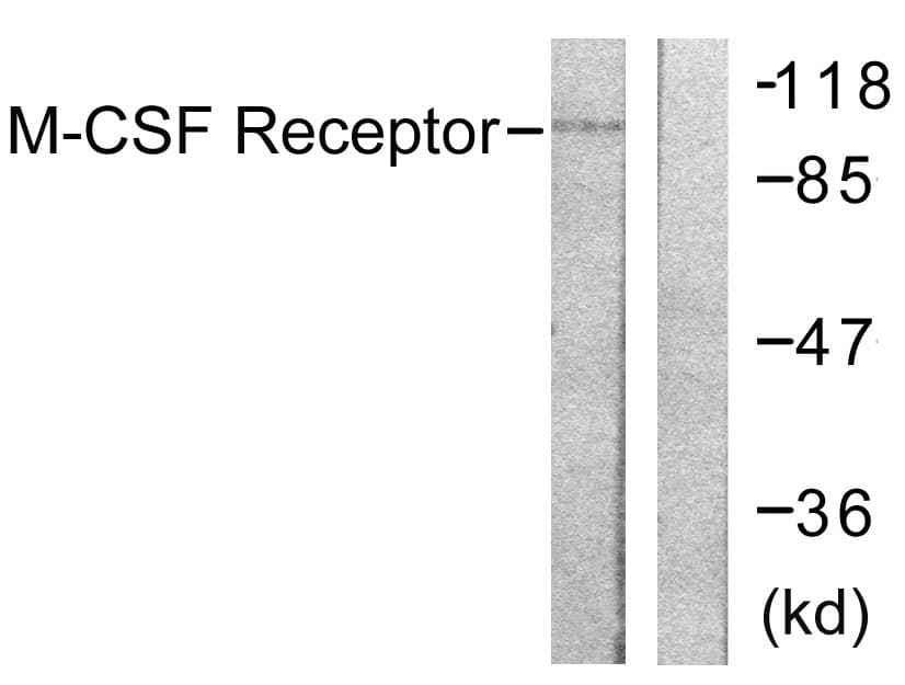 CSF1R / CD115 / FMS Antibody (aa781-830)