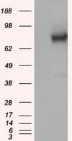 GBE1 Antibody (clone OTI3B4)