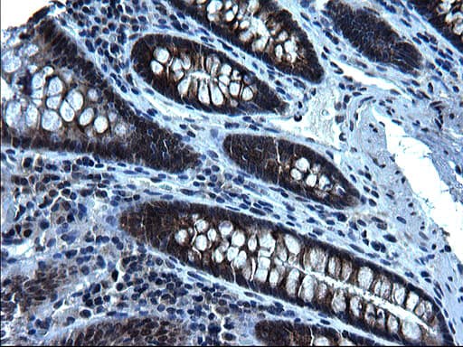 ZFAND3 / TEX27 Antibody (clone OTI1H10)