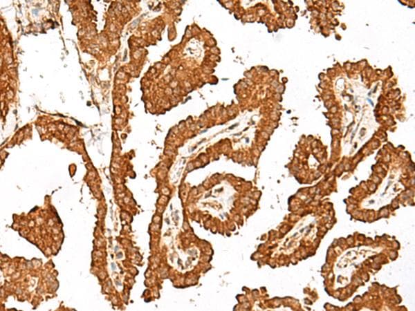 GBP4 / Mpa2 Antibody