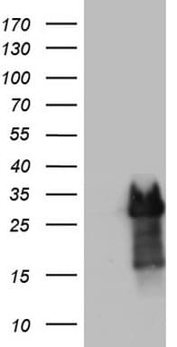 Monoclonal Mouse anti-Human PRX-1 / PRRX1 Antibody (clone OTI6A4, IHC, WB)