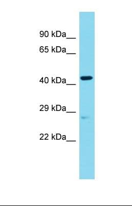Polyclonal Rabbit anti-Human ANGEL2 Antibody (aa64-113, WB)