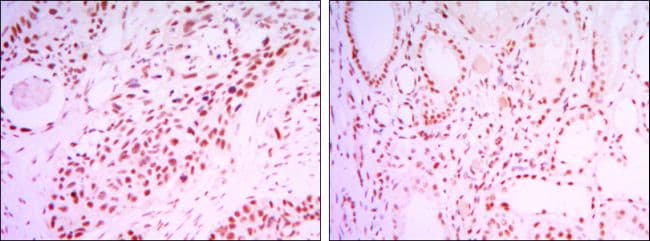 SIRT1 / Sirtuin 1 Antibody (clone 1F3)