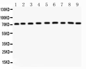 Growth Hormone Receptor / GHR Antibody (aa231-247)