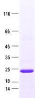 Human ARPC4 Protein (Recombinant His, N-Terminal)