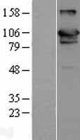Human USP20 / VDU2 Protein (Over-Expression Lysate Myc-DDK (Flag))