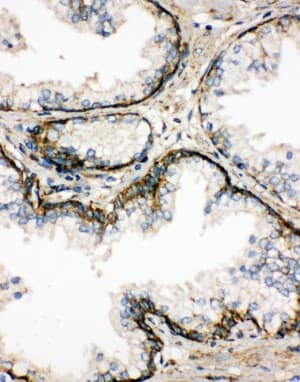 Polyclonal Rabbit anti-Human SSR3 / TRAP-Gamma Antibody (aa8-23, IHC, WB)