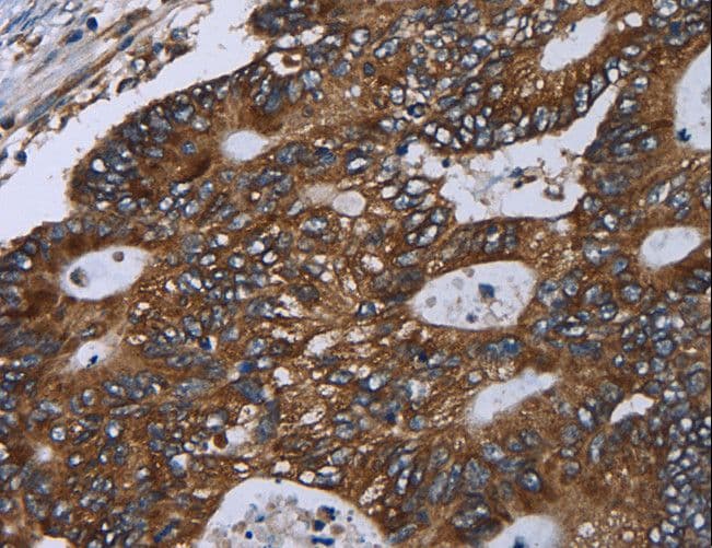 GOLGA2 / GM130 Antibody