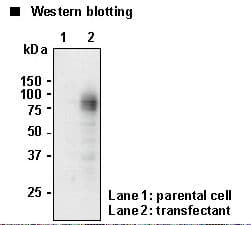 Polyclonal Rabbit anti-Human SLC6A14 Antibody (IHC, WB)
