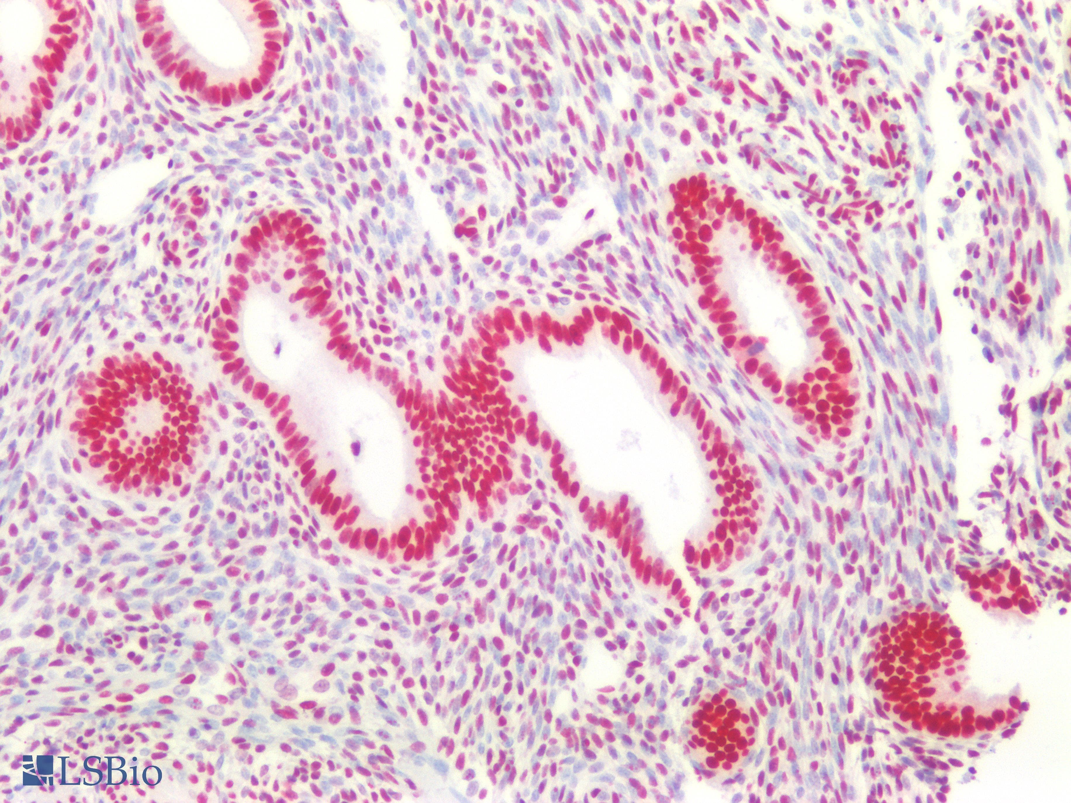 PathPlus™ Monoclonal Mouse anti-Human CBX3 / HP1 Gamma Antibody (IHC, WB)