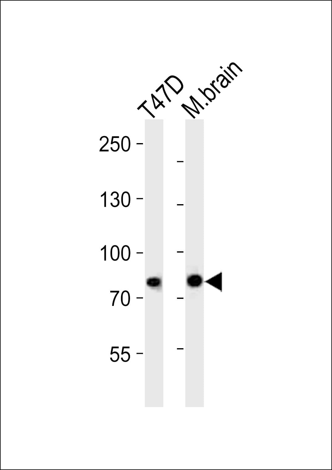 ACAP2 / Centaurin Beta 2 Antibody (aa489-522)