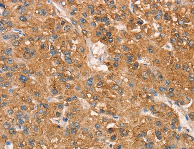 Polyclonal Rabbit anti-Human ART4 Antibody (IHC, WB)