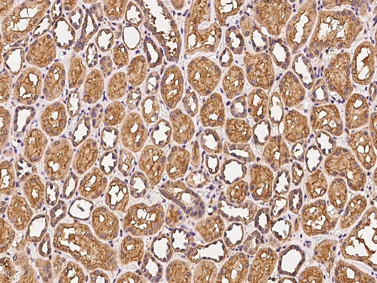 CLRN3 Antibody