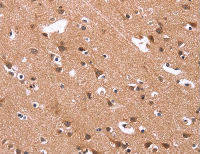 HSD17 / HSD17B1 Antibody
