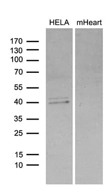 Monoclonal Mouse anti-Human BCL7B Antibody (clone OTI2D9, Carrier-free, WB)