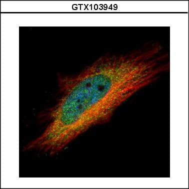 Polyclonal Rabbit anti-Human IP6K1 Antibody (aa50-309, IHC, WB)