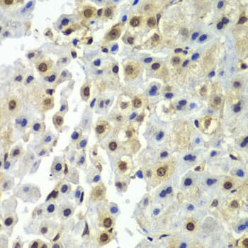 SYNCRIP / HnRNP Q Antibody
