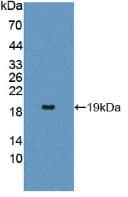 Human IL17RA Protein (Recombinant His, N-Terminal)