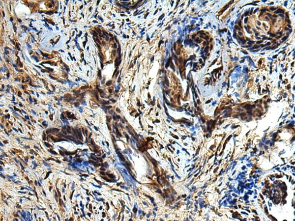 Polyclonal Rabbit anti-Human TBCC Antibody (IHC)