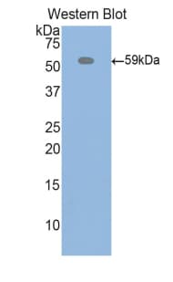 ITIH4 Antibody (aa478-722)