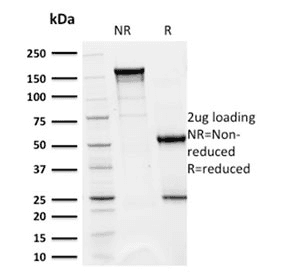 CD5 Antibody (clone CD5/2418)