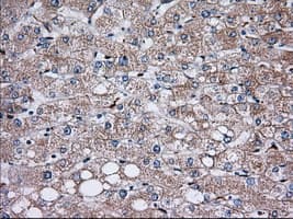 Monoclonal Mouse anti-Human TS / Thromboxane Synthase Antibody (clone OTI1H1, IHC, IF, WB)