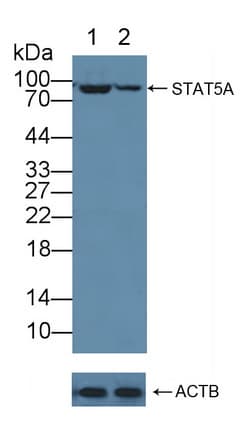 STAT5A Antibody (aa673-773)