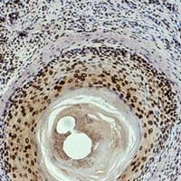 Monoclonal Mouse anti-Human HIST1H3H Antibody (IHC, WB)