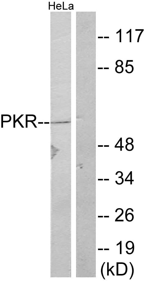 Polyclonal Rabbit anti-Human EIF2AK2 / PKR Antibody (aa413-462, IHC, WB)