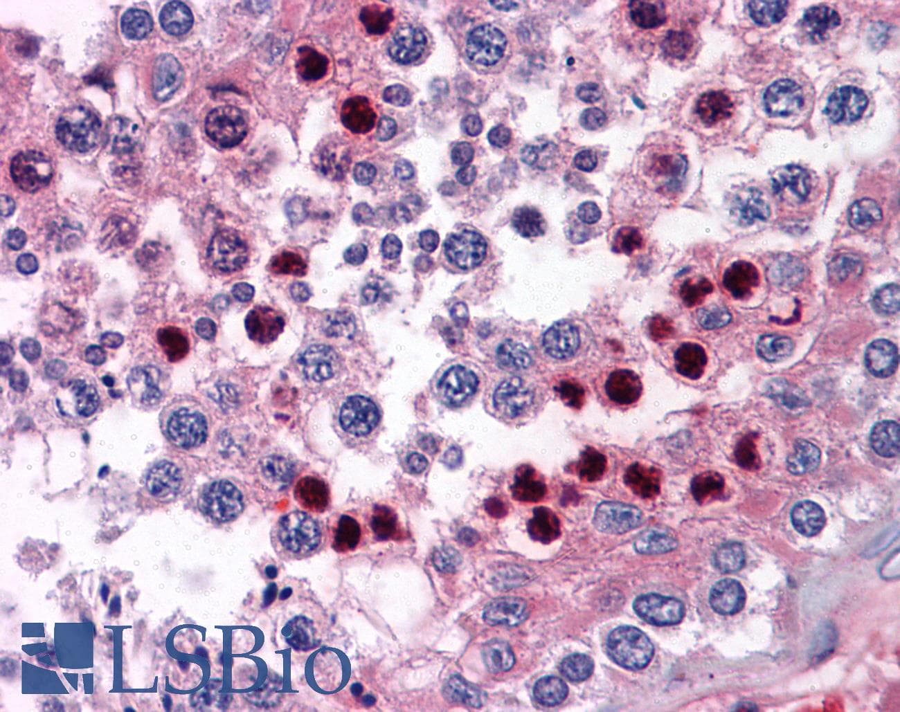 IHC-plus™ CORO1B Antibody (clone 1E7)