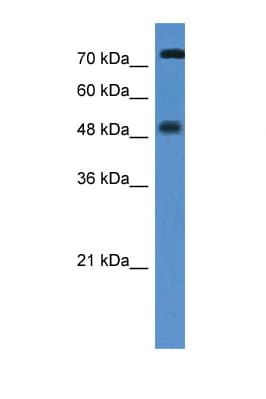 Vitamin D Receptor / VDR Antibody (aa108-157)