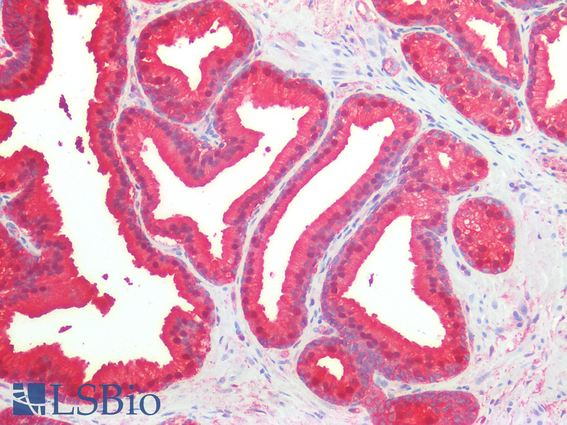 IHC-plus™ NDRG1 Antibody (clone AT11G4)